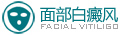 面部白癜風