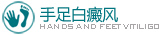 手部白癜風
